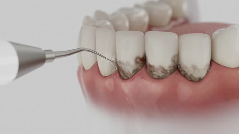 Reliable Dental Implants contractor in Butler, OH by Smile Center Dentistry